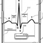 iphone-ekg1